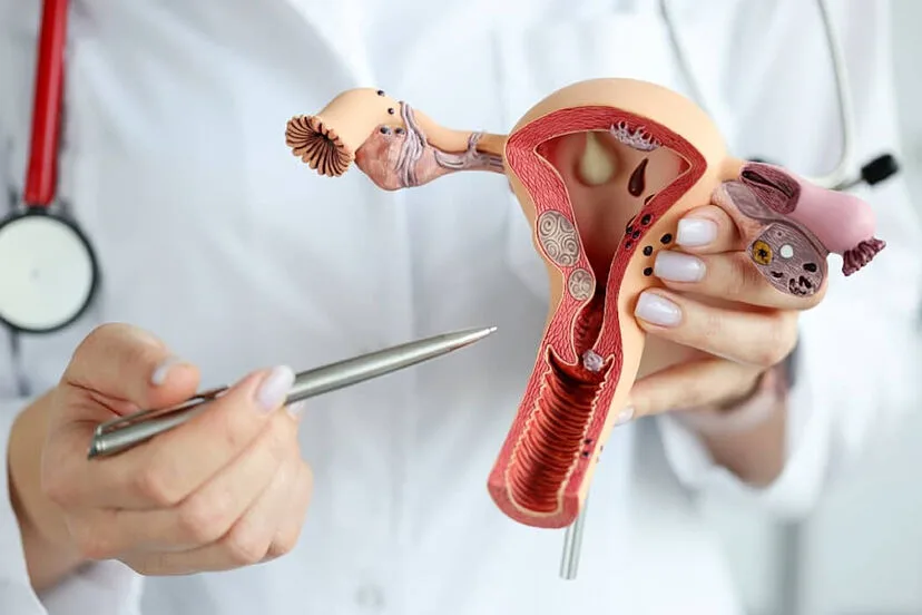 El aumento de casos de cáncer de útero: ¿A qué se debe?